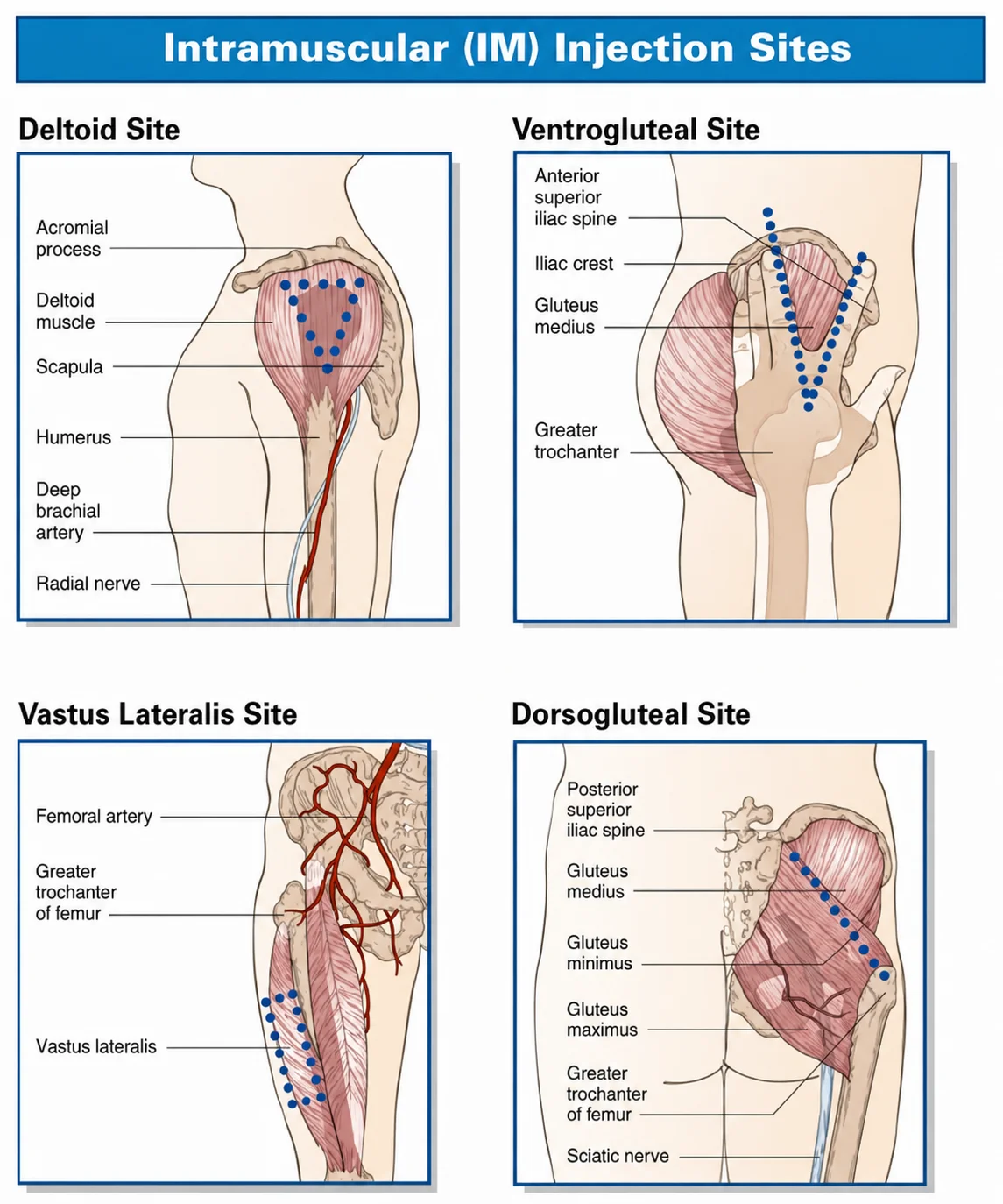 Intramuscular injection sites