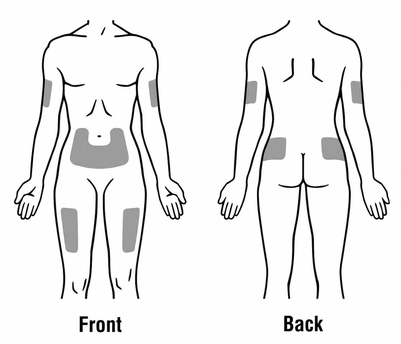 Subcutaneous injection sites